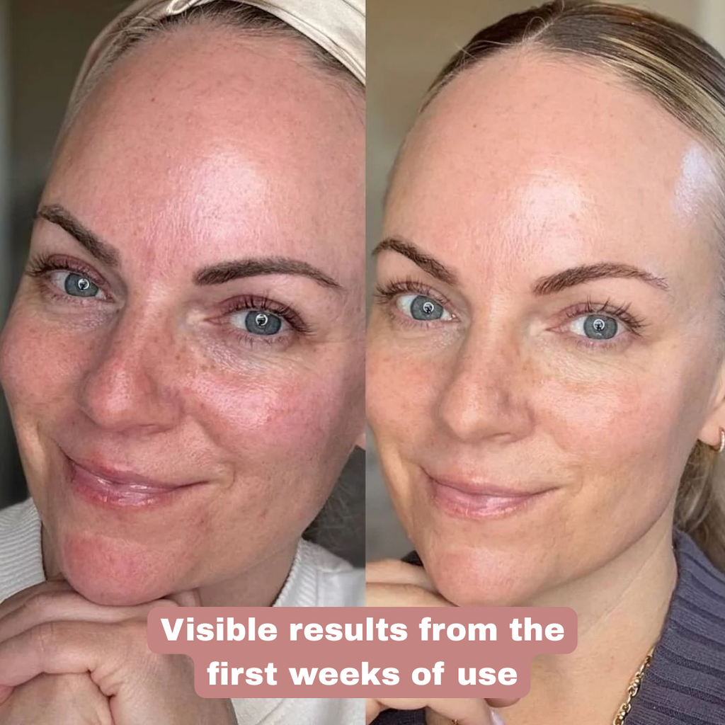 BEKI MASSAGER: Facial and Neck