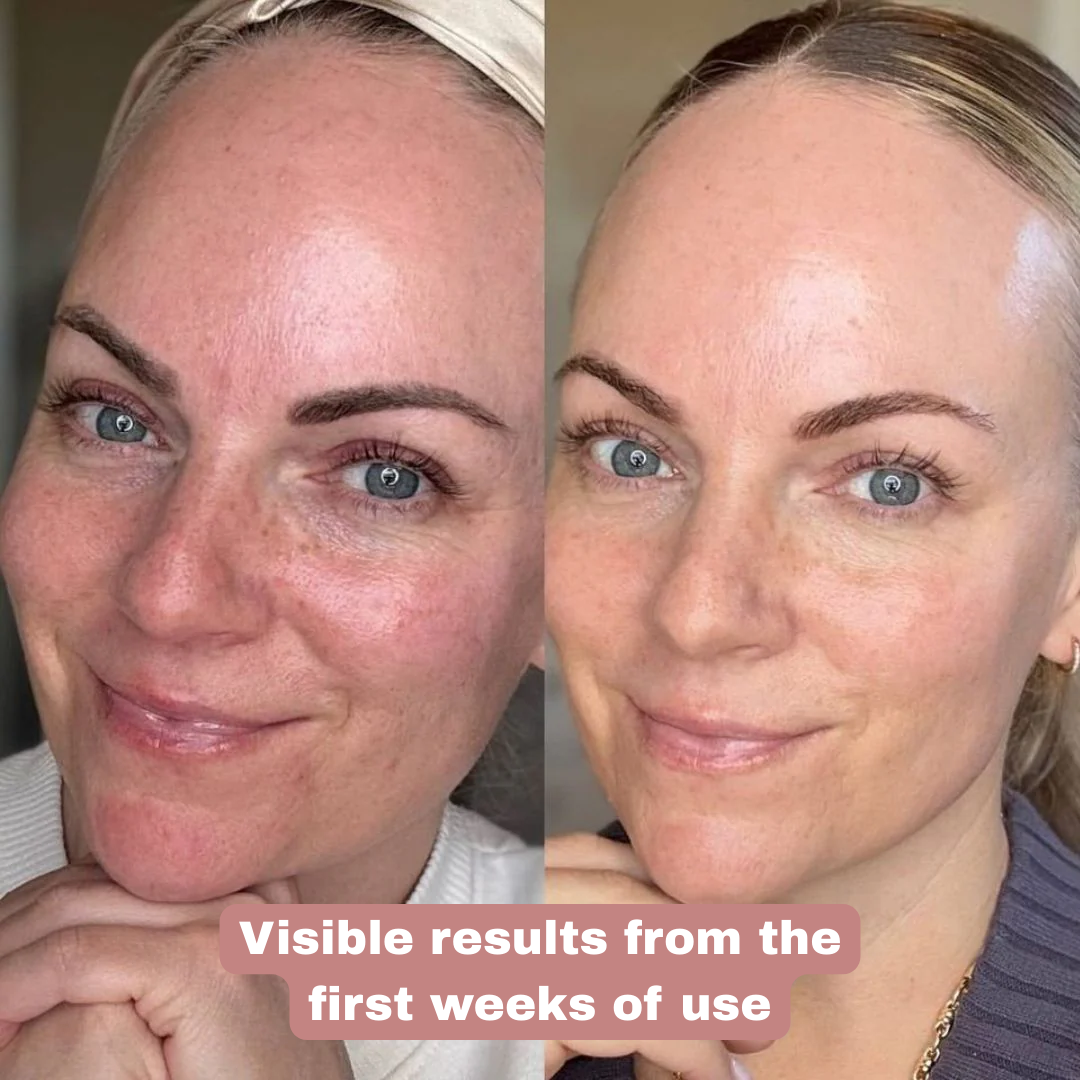 BEKI MASSAGER: Facial and Neck