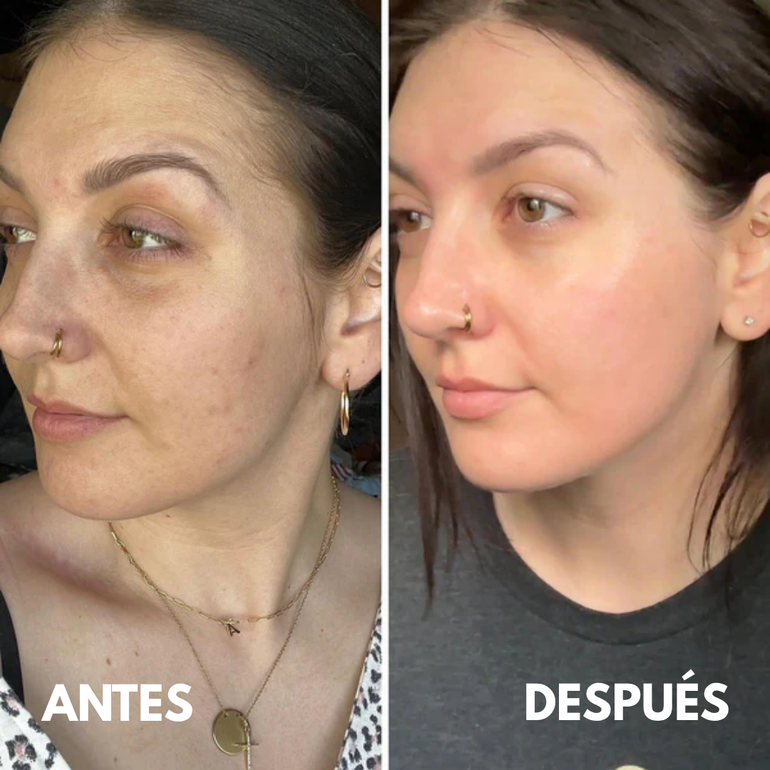 Mascarilla Regeneradora Intensiva de Colágeno Beki™