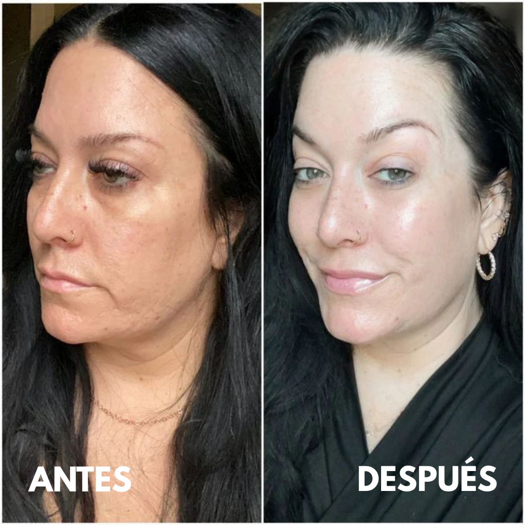 Mascarilla Regeneradora Intensiva de Colágeno Beki™