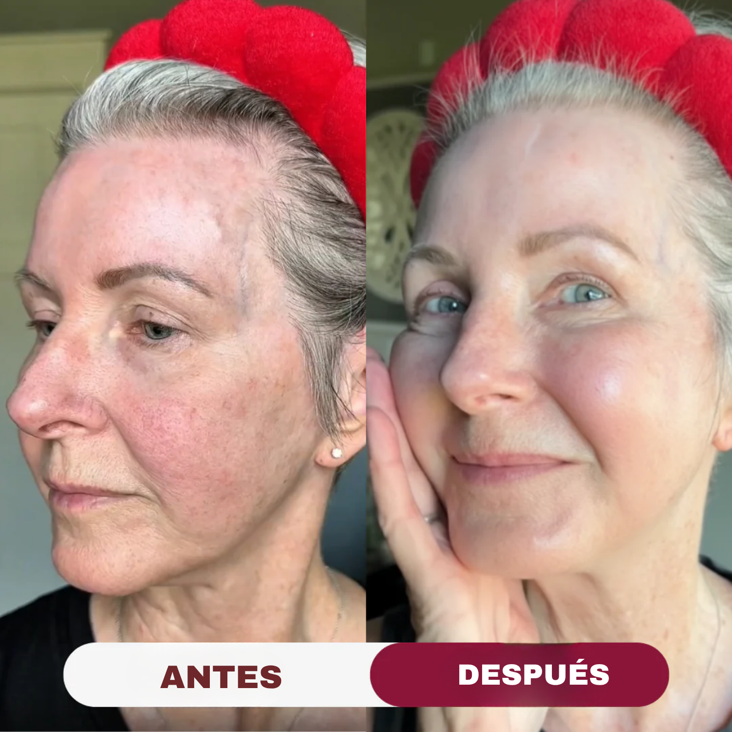 Mascarilla Regeneradora Intensiva de Colágeno Beki™