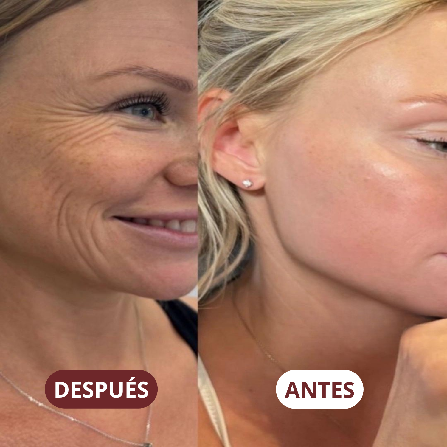 Mascarilla Regeneradora Intensiva de Colágeno Beki™